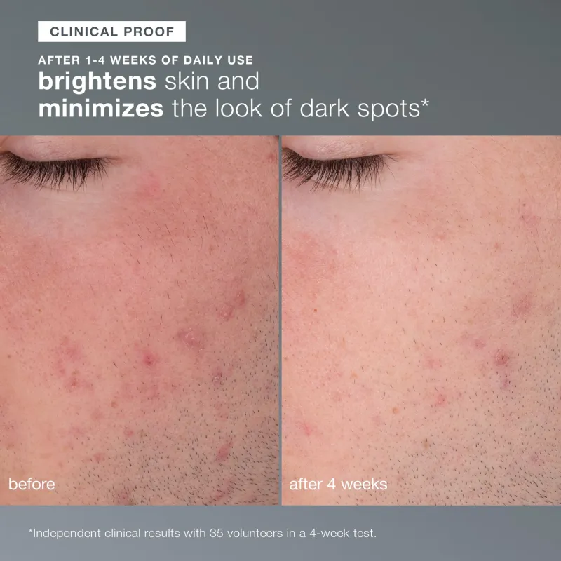 Dermalogica Daily Microfoliant Exfoliator 74g